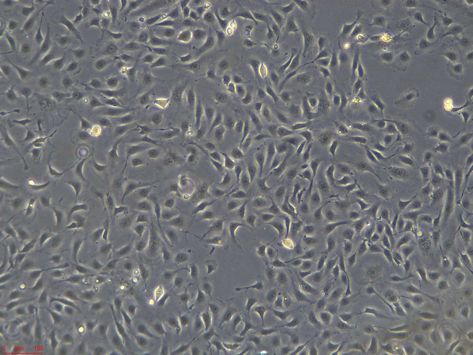 人脐带动脉内皮细胞