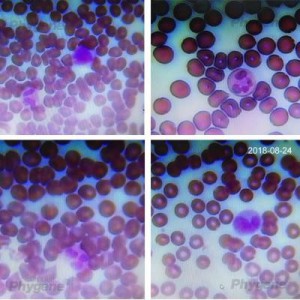 PH1057 | 迪夫快速染色液（Diff-Quik Staining Solution）