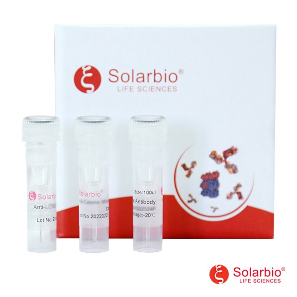 Anti-KDM5C/Jarid1C/SMCX Monoclonal Antibody