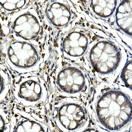 Anti-TEC Polyclonal Antibody