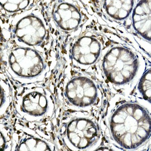 Anti-TEC Polyclonal Antibody