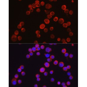 Anti-TEC Polyclonal Antibody