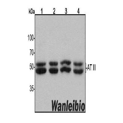 抗凝血酶III/Antithrombin III/AT III