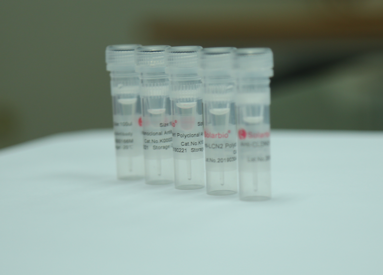 羊抗人纤维蛋白原（免疫血清）